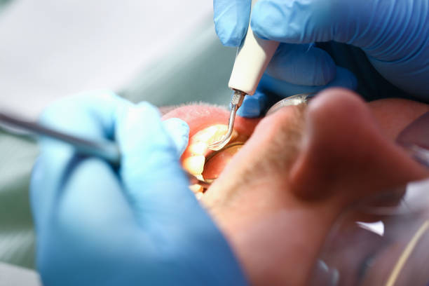 Best Urgent Care for Lost Fillings or Crowns in , MN